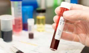 Mais de 1,4 mil pacientes com HIV abandonaram tratamento em MT (Crédito: Divulgao)