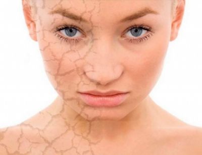 Minha pele pede socorro: dermatologista ensina o que fazer no tempo seco