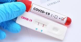 Mortes por Covid-19 aumentam 54% e Cuiab registra em mdia 12 bitos por dia