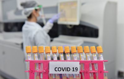 Vacina de Oxford para Covid-19  segura e induz resposta imune, indicam resultados preliminares