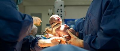 ​Lei probe qualquer cobrana ao acompanhante para assistir parto