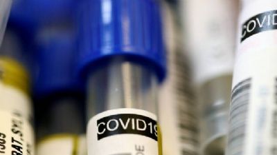 Cientistas europeus testam quatro tratamentos contra novo coronavrus