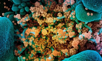 Sistema imune pode derrotar coronavrus sem produzir anticorpos, sugere estudo