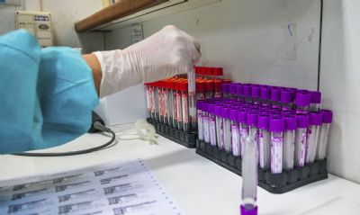 Estudo brasileiro diz corticoide reduz gravidade de efeitos da covid-19
