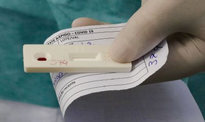 Brasil tem mais de 2 milh�es de casos de covid-19 e 79 mil mortes