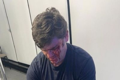 Marqueteiro do prefeito Ricardo Nunes leva seis pontos ap�s ser agredido por assessor de Mar�al