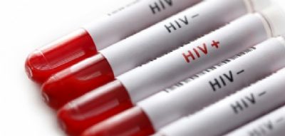 Cuiab� registra 40 novos casos de HIV por m�s; campanhas alertam sobre casos