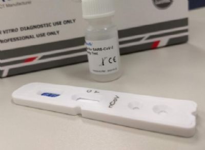 Governo recebeu 56 mil testes r�pidos da Covid-19 da Uni�o e aplicou mais da metade de vacinas