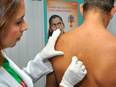 Equipes de sa�de que atuam nas penitenci�rias s�o capacitadas para diagn�stico da hansen�ase
