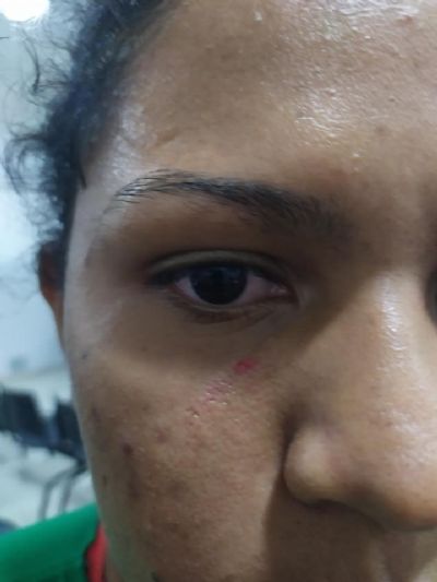 Crian�as s�o agredidas em pra�a devido brincadeira com bola