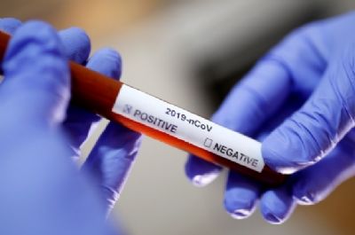 Unimed confirma 3 casos de Covid-19 em Rondon�polis