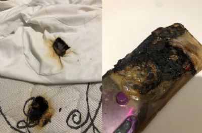 Cuiabano sofre queimaduras ap�s celular pegar fogo e explodir em cima da cama