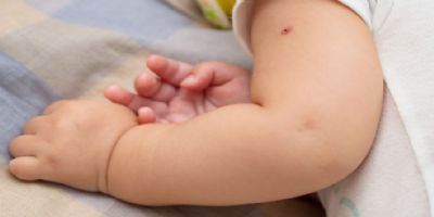 Secretaria de Sa�de divulga cronograma atualizado de aplica��o da vacina BCG