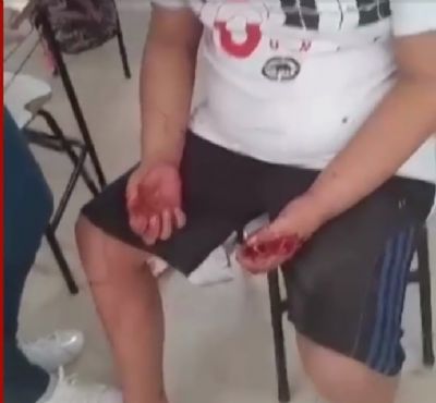 Aluno tem crise de ansiedade e � agredido por professor em escola de MT