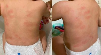 Diretora de creche � exonerada ap�s m�e denunciar maus-tratos