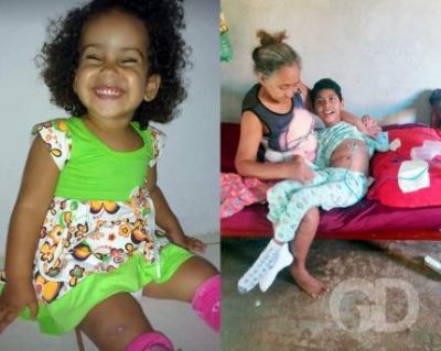 Em V�rzea Grande, crian�as precisam de cadeiras de rodas