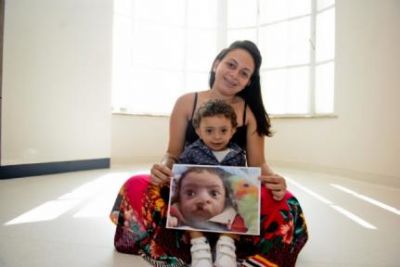 Projeto busca padrinhos para crian�as com l�bio leporino e fenda palatina