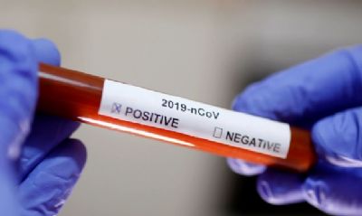 Notifica��es de pacientes com s�ndrome respirat�ria passam de mil