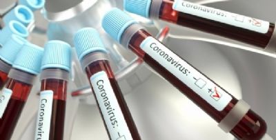 Com explos�o de casos, Mato Grosso � o Estado que menos fez teste para o coronav�rus