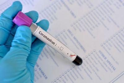 Mato Grosso j� contabiliza 30 mortes e se aproxima de mil casos confirmados de coronav�rus