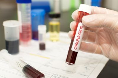 Estudo aponta que Cuiab� j� teria mais de 11 mil pessoas infectadas pelo coronav�rus