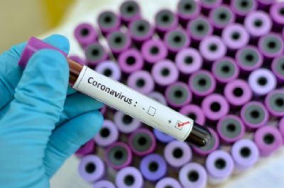Coronav�rus se espalha pelo interior e Mato Grosso chega a 76 casos confirmados