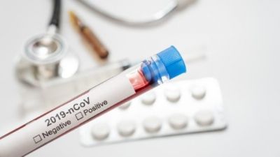 Mato Grosso ultrapassa os 300 casos, mas mant�m 11 �bitos pelo novo coronav�rus