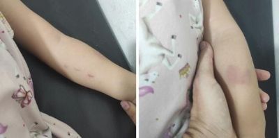 Equipe coordenadora e professoras s�o afastadas de creche onde crian�a autista foi agredida