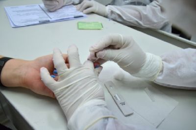 Veja onde fazer teste r�pido da Covid-19 e RT-PCR em Cuiab� pelo SUS