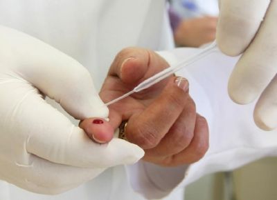 Mais de 700 casos de pessoas com o v�rus HIV s�o registrados neste ano em MT
