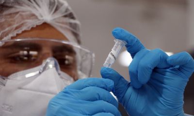 Covid-19 tem mais de 30 milh�es de casos em todo o mundo