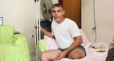 Com perna amputada, gari atropelado por procuradora tem benef�cio cortado
