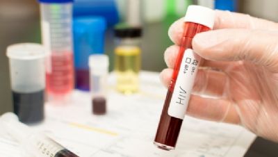 ​Mais de 1,4 mil pacientes com HIV abandonaram tratamento em MT
