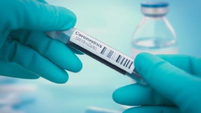 Mato Grosso se aproxima dos tr�s mil testes acumulados e n�meros reais da Covid-19 continuam defasados