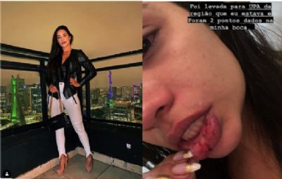 Suspeito de agredir cuiabana pagou R$ 1100 de fian�a e foi liberado