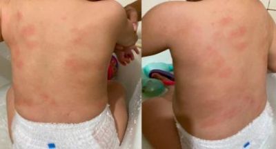 ​Profissionais s�o demitidas ap�s confirma��o de agress�o