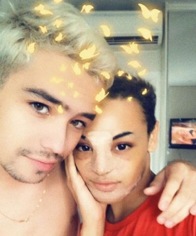 PABLLO VITTAR POSA COM CURATIVO NO ROSTO E DIZ: 