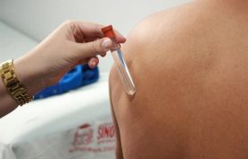 ​Novos casos de hansen�ase s�o diagnosticados durante mutir�o em Sinop