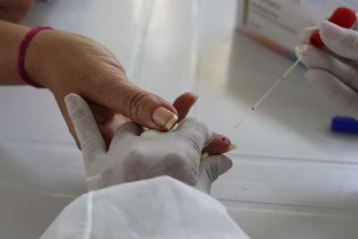 MT tem 158 mil casos de coronav�rus; nove morreram nas �ltimas 24 horas