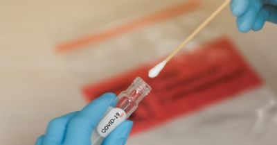 Mais de 27% das pessoas que fizeram teste para Covid-19 foram diagnosticados com a doen�a em MT