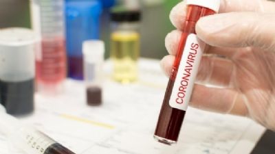 Unimed divulga seis casos confirmados de coronav�rus em Rondon�polis