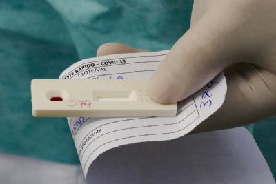 Testes r�pidos de covid ainda fazem sentido para a �micron?