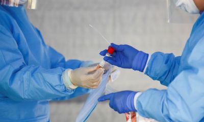 Brasil acumula 867,6 mil casos do novo coronav�rus