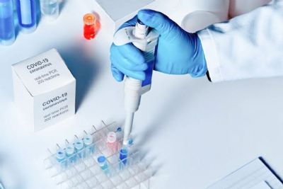 Anvisa aprovou extens�o da validade dos testes para Covid-19 estocados pelo governo