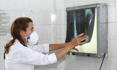 Pesquisadores v�o testar vacina contra tuberculose durante a pandemia da COVID-19