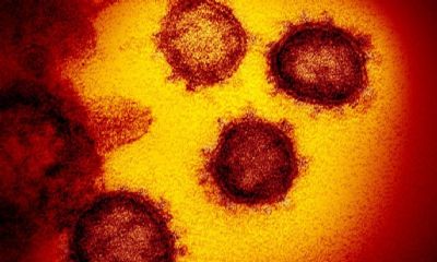 Anvisa busca lista de passageiros que voaram com brasileiro contaminado por coronav�rus